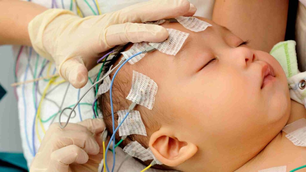 Children in hospital going through tDCS therapy