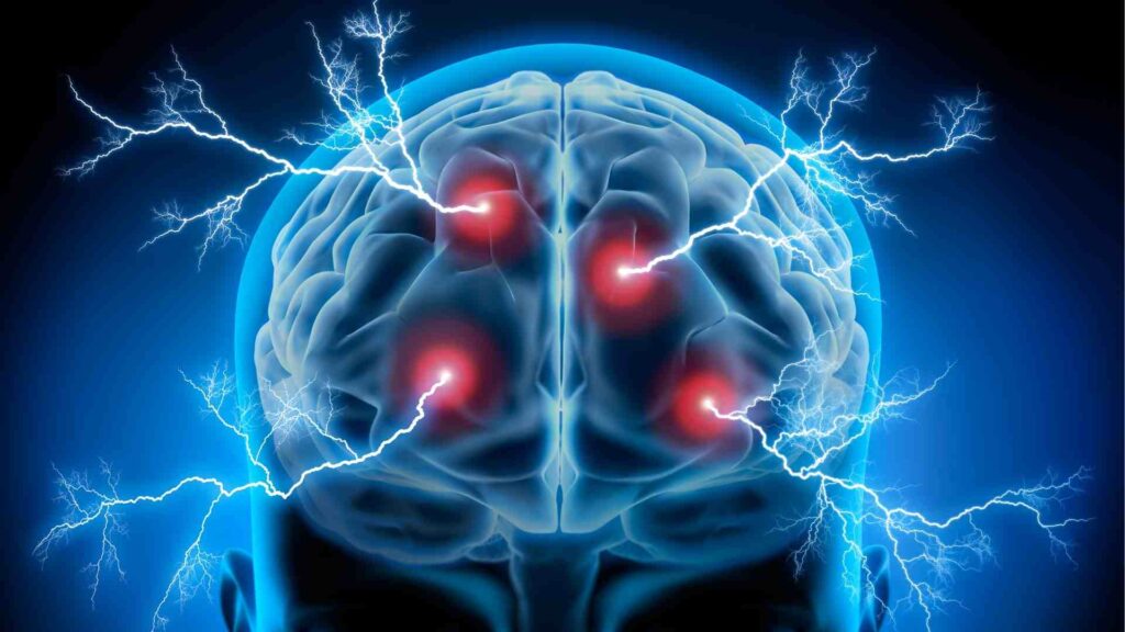 Example of how neurostimulation works