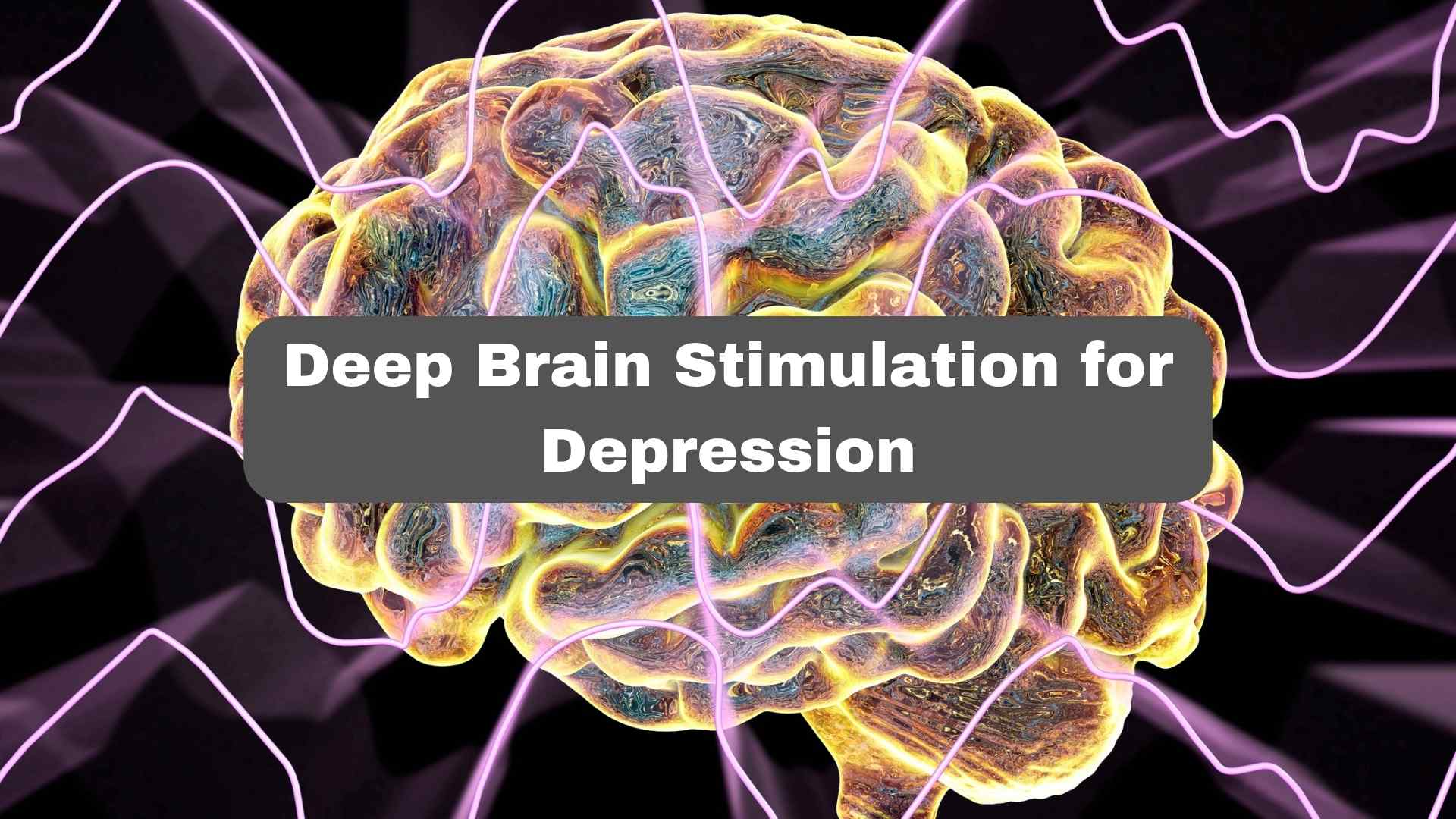 Deep Brain Stimulation for Depression